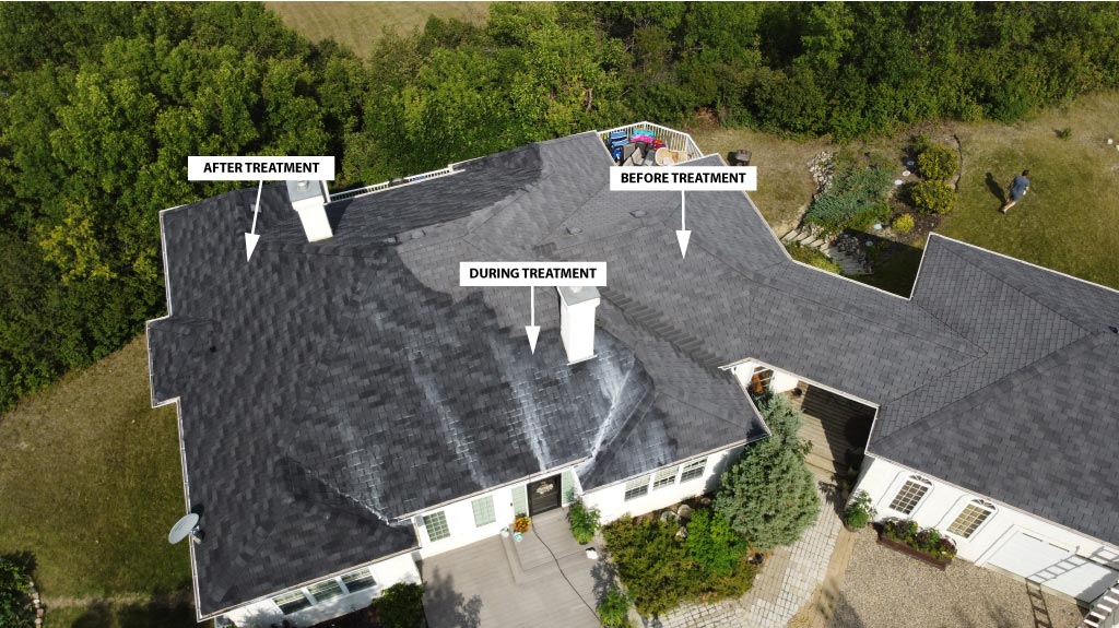 Before During and After Roof Rejuvenation Treatment